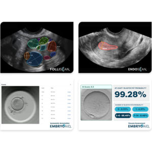 Software de inteligencia artificial MIM Fertility para clínicas de reproducción asistida distribuido por Nanog Biotec.
